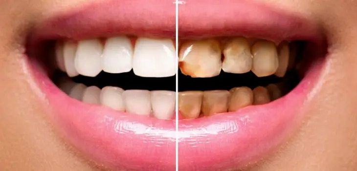 Bossier City Rabalais Dental Centre