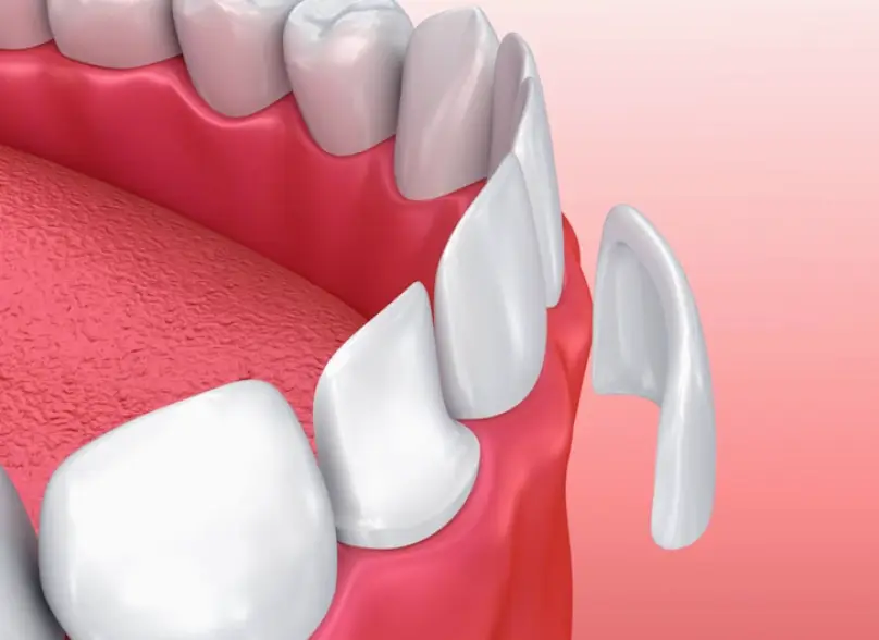 Clackamas Sunnyside General Dentistry
