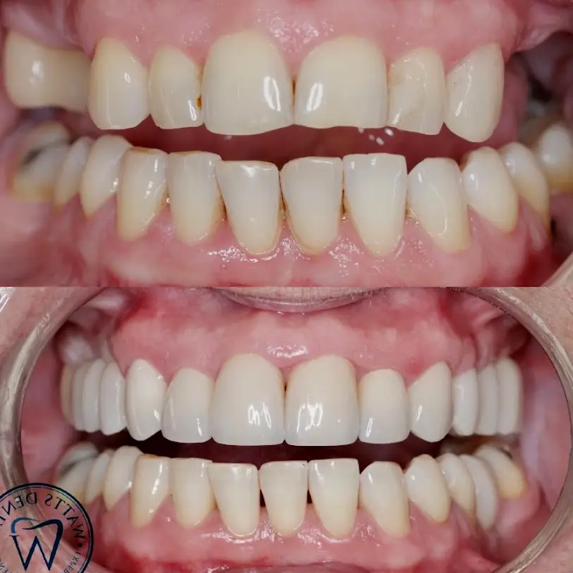 Lithia Watts Dental