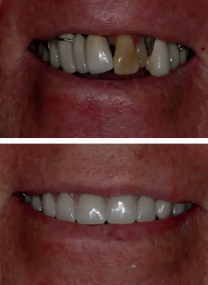 Tacoma Distinctive Dentistry