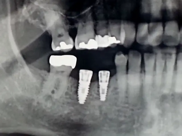  Hamburg Affordable General Dentistry & Implants