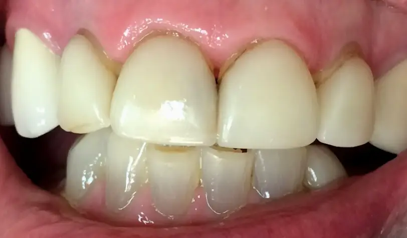  Reno Double Diamond Dental: Michael A Morgan DDS