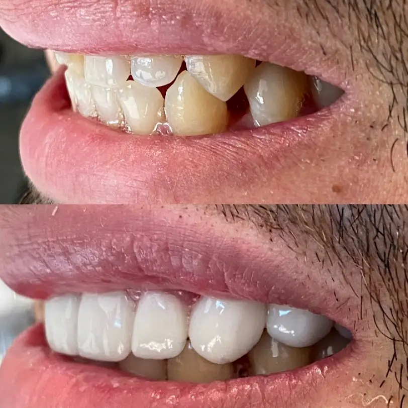 The Colony D. Dental