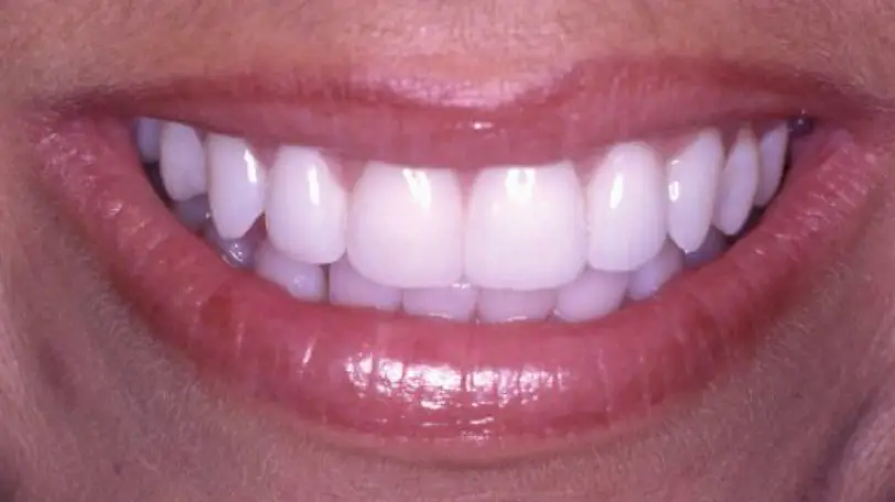 Los Gatos Dental Care