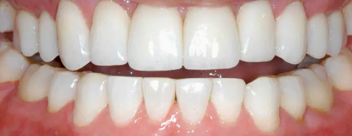 Pinole Edward Jang, DDS & Associates