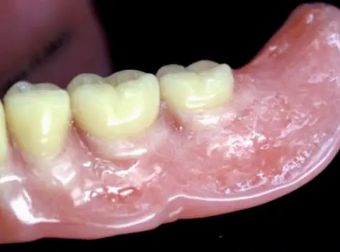 Meridian PrimeBilt Dental Lab