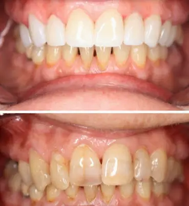Vienna Barnhart Dental