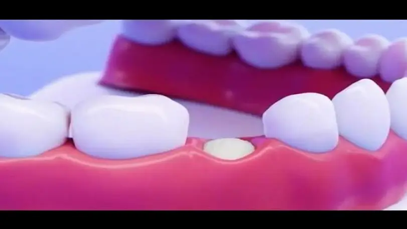 Pomona CA Periodontics & Implant Clinic