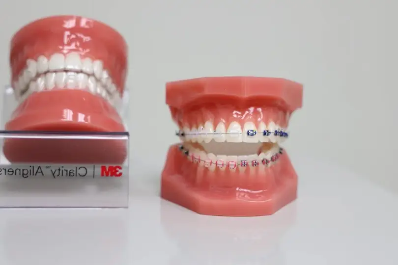 Syosset Always Orthodontics | Dr. Ava Kamenshchik