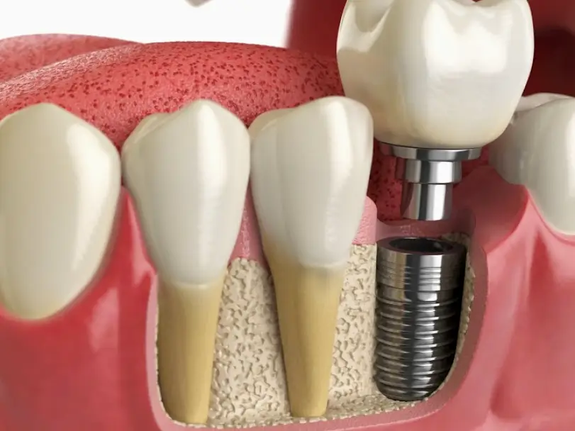 Woodland Hills Alexander Visot,DDS