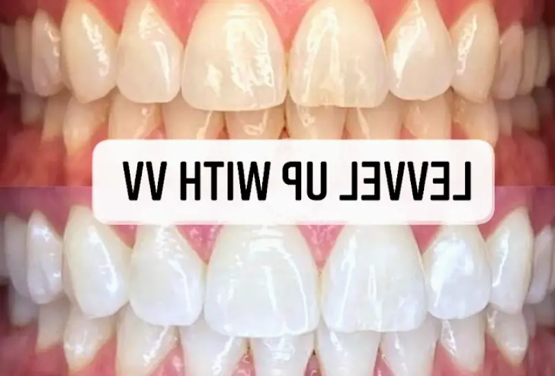 Evansville LeVvel Up With Vv Tooth Gems ,Teeth Whitening & More