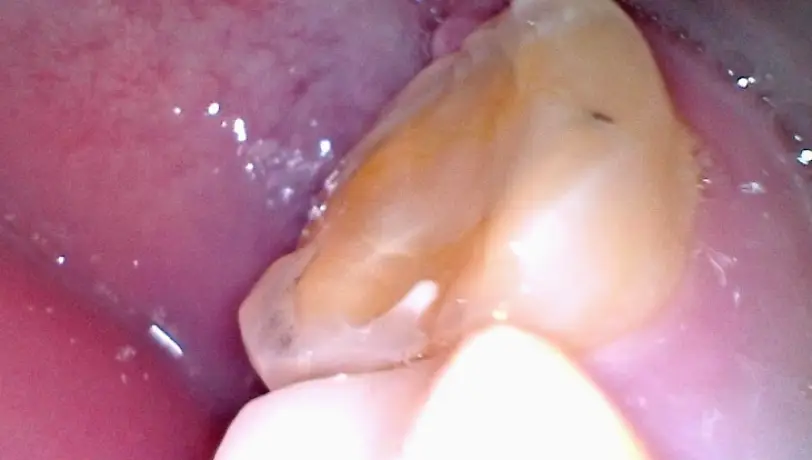 Munster Dental Center - Dr. Jim Frankos D.D.S.