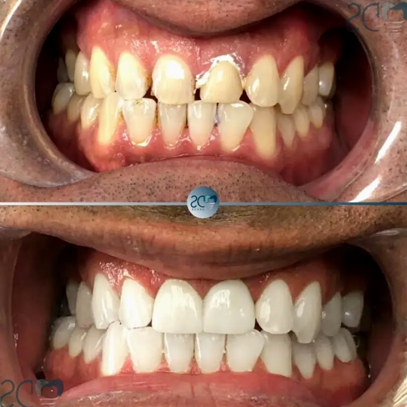  Pembroke Pines EMERGENCY DENTIST IN PEMBROKE PINES