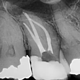 Quakertown North Penn Endodontics Group