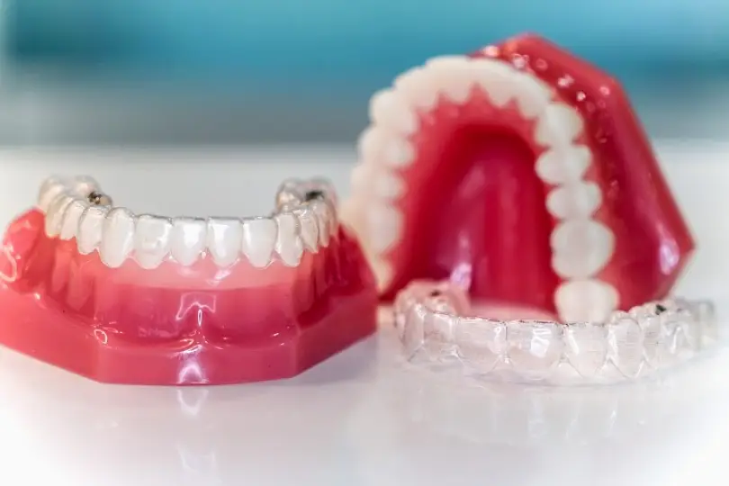 Sean Pierce, DDS - Implant and Cosmetic Dentist - Tustin, CA