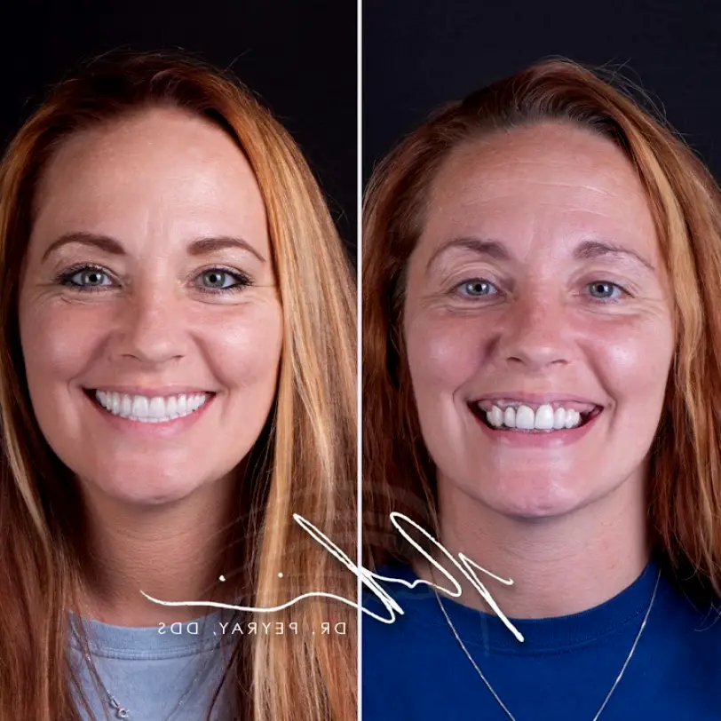  Nashville My New Smile Dental