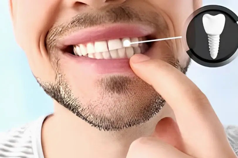 Spring Auburn Lakes Periodontics & Dental Implants