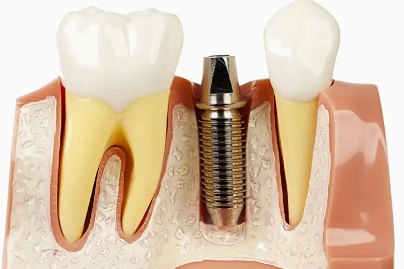 Chesapeake Meeks Oral and Maxillofacial Surgery: Meeks Darrell A DDS