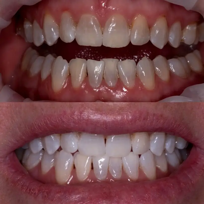 Mission Dental - Placentia