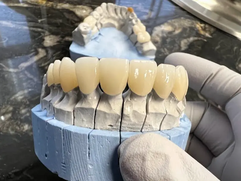 Los Algodones ADAGIO Implants & Orthodontics Algodones