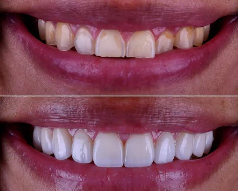 Carlsbad Beach Dental - Drew Addy, DDS