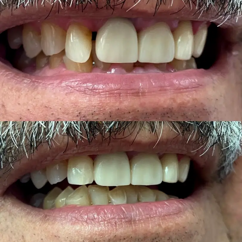Santa Maria Blatchley Family Dentistry: Ryan T. Blatchley, DDS