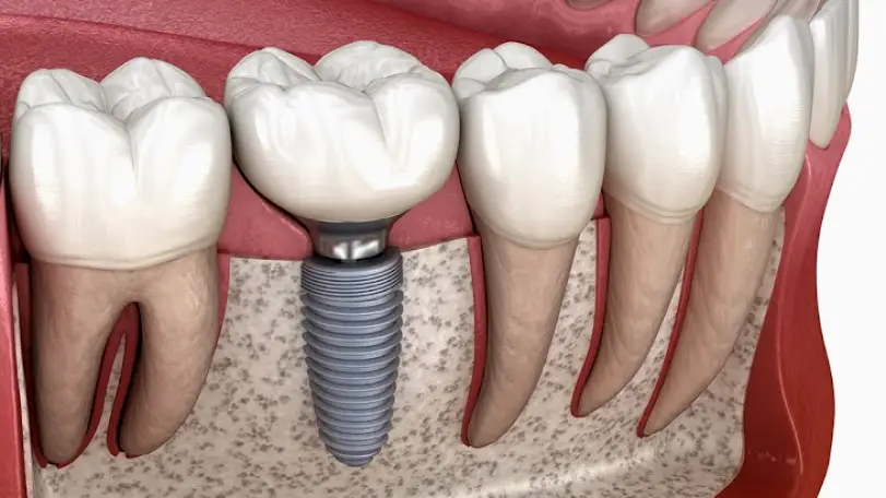 Sumter Crescent Family and Cosmetic Dentistry
