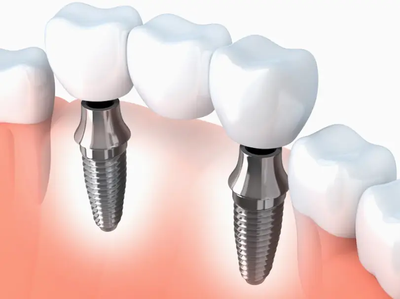 Unique Dental of Putnam