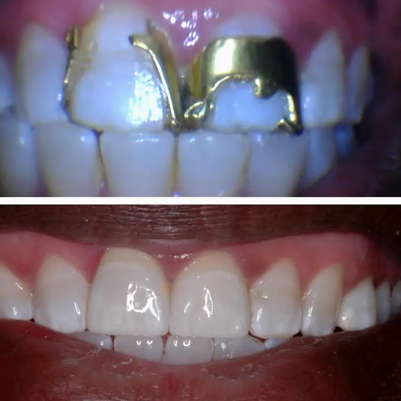 Bartlett Damron Dental Care