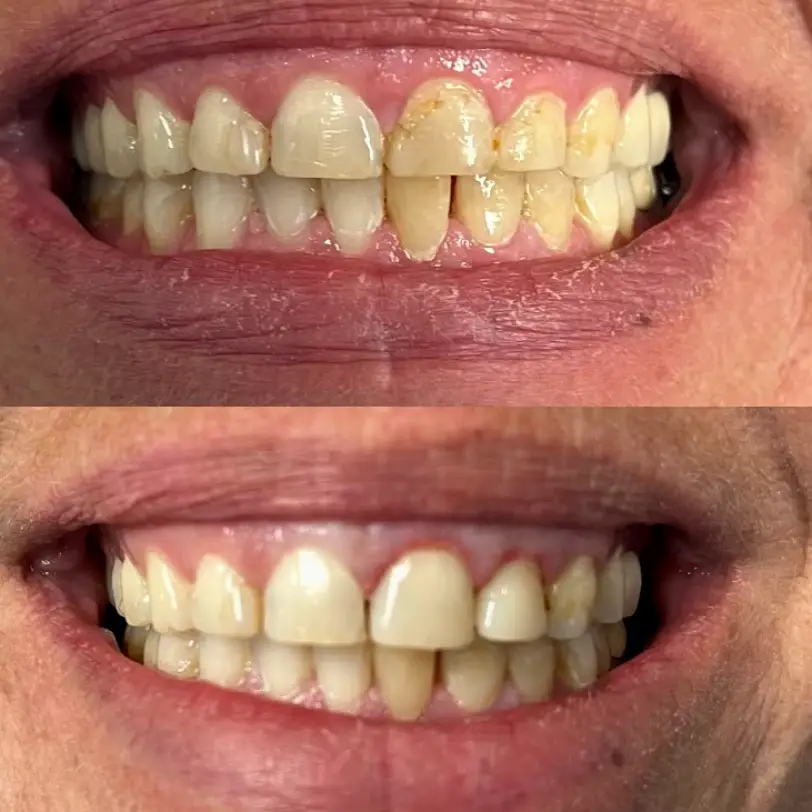 Dr. Ayotunde Esho - Basin Dental Suite Odessa