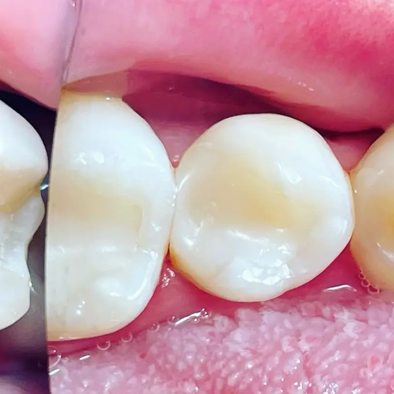  New York Preserve Your Teeth Dentistry - Alice Urbankova, DDS, PHD - Rockefeller Center, Manhattan