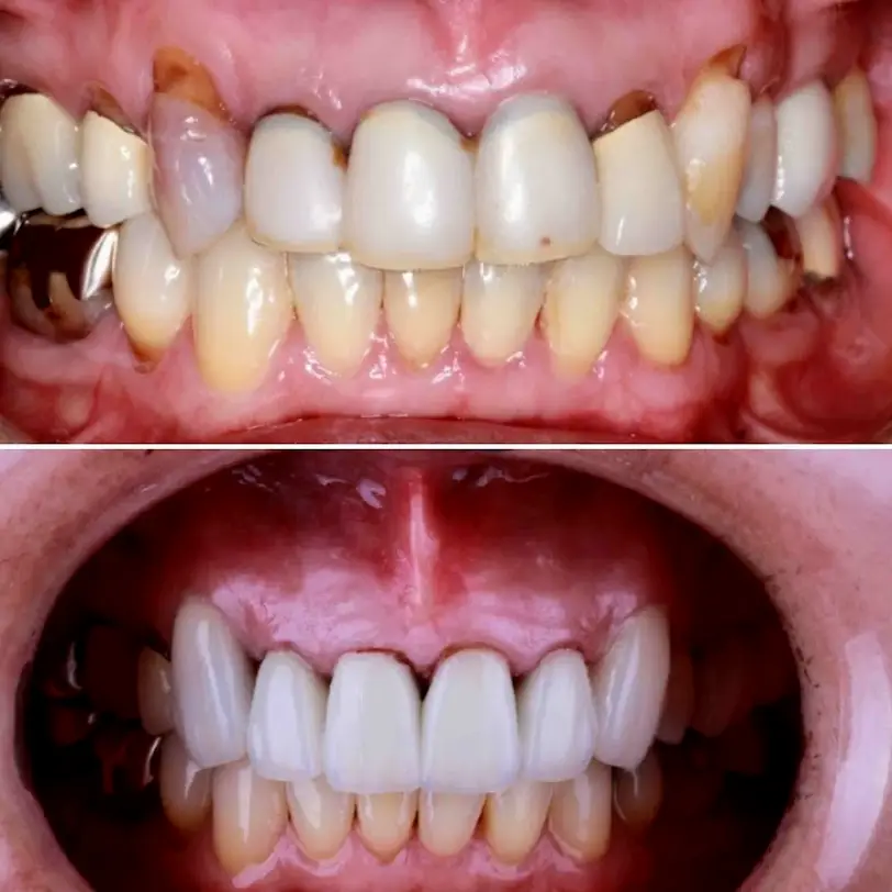 Tijuana TJ Endodontics
