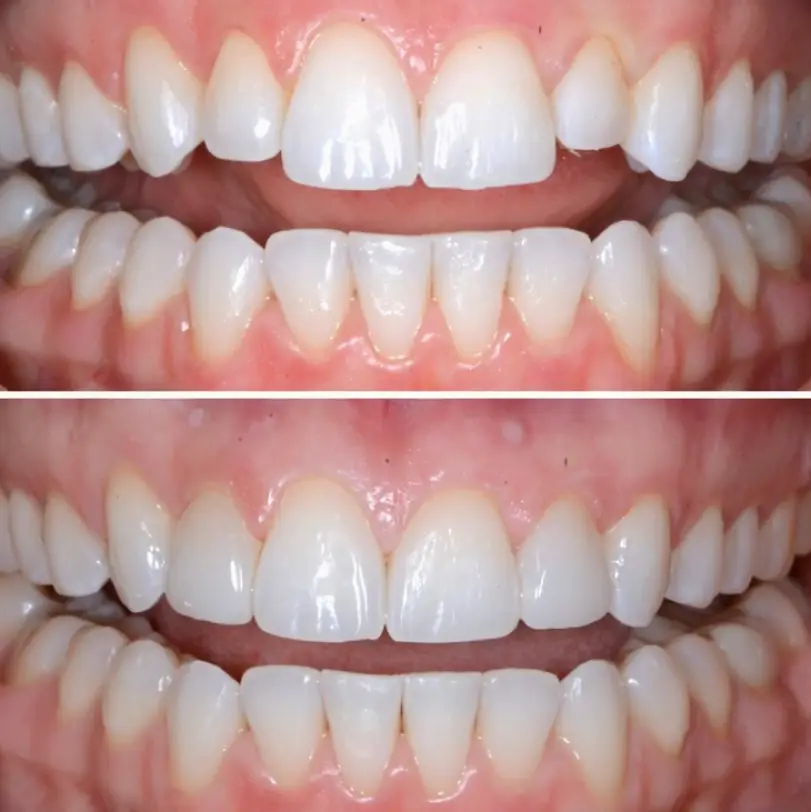 Union Square Days to Smile Orthodontics