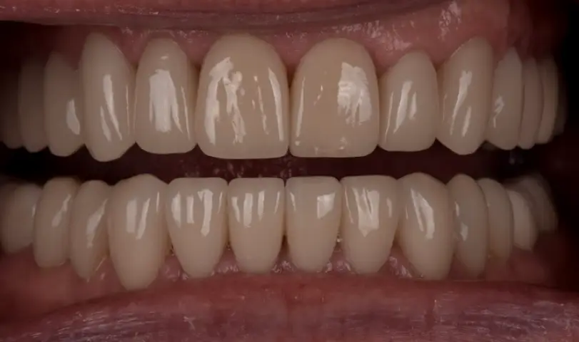 Battle Ground Above & Beyond Dentistry & Implants