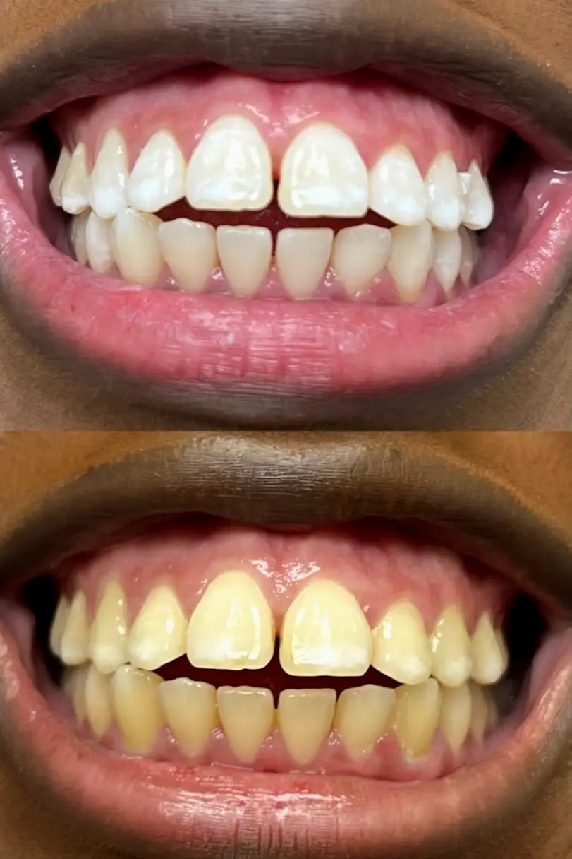 Oakland Gardens Premier Dental