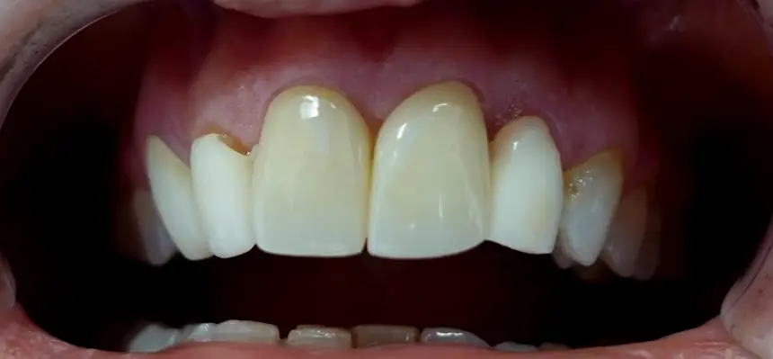 Englewood Cliffs ReNU Dental Care