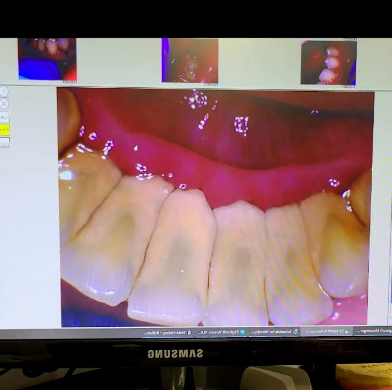 Hershey East Chocolate Dental