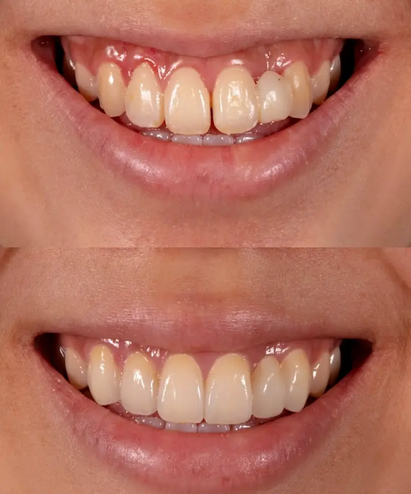 Cliffside Park Hesed Dental | Cosmetic dentistry NJ