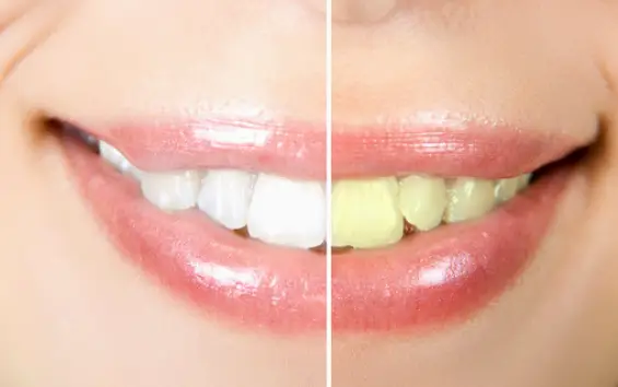 Fort York Dentist | Downtown Toronto Dental Clinic
