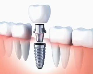  West Orange Bagoff Dental Arts - General Family Dentist & Dental Implant Specialist