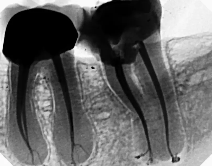 Conroe Ellis Endodontics