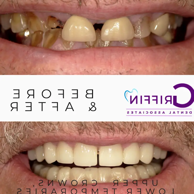 Lawton Griffin Dental Associates