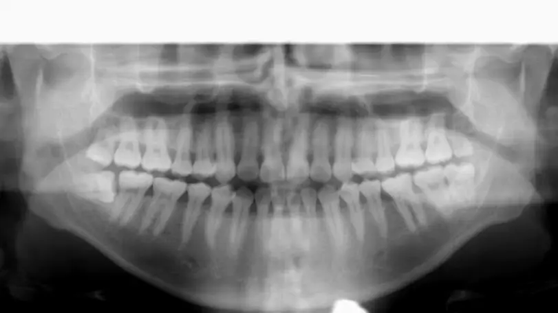 North Bergen Emergency Dentist
