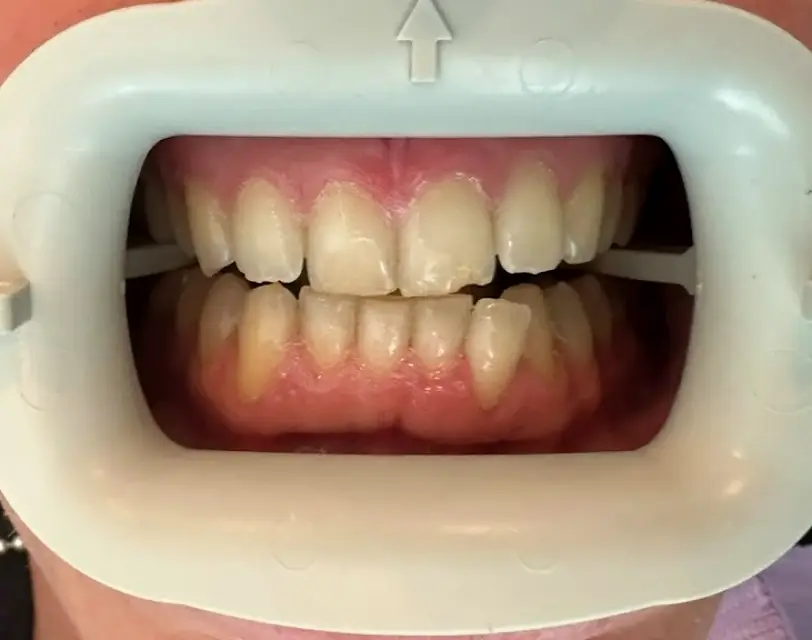  Miami Beach SoFi Dental Care & Orthodontics