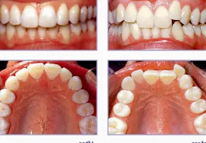 Bee Cave Oak Canyon Dentistry