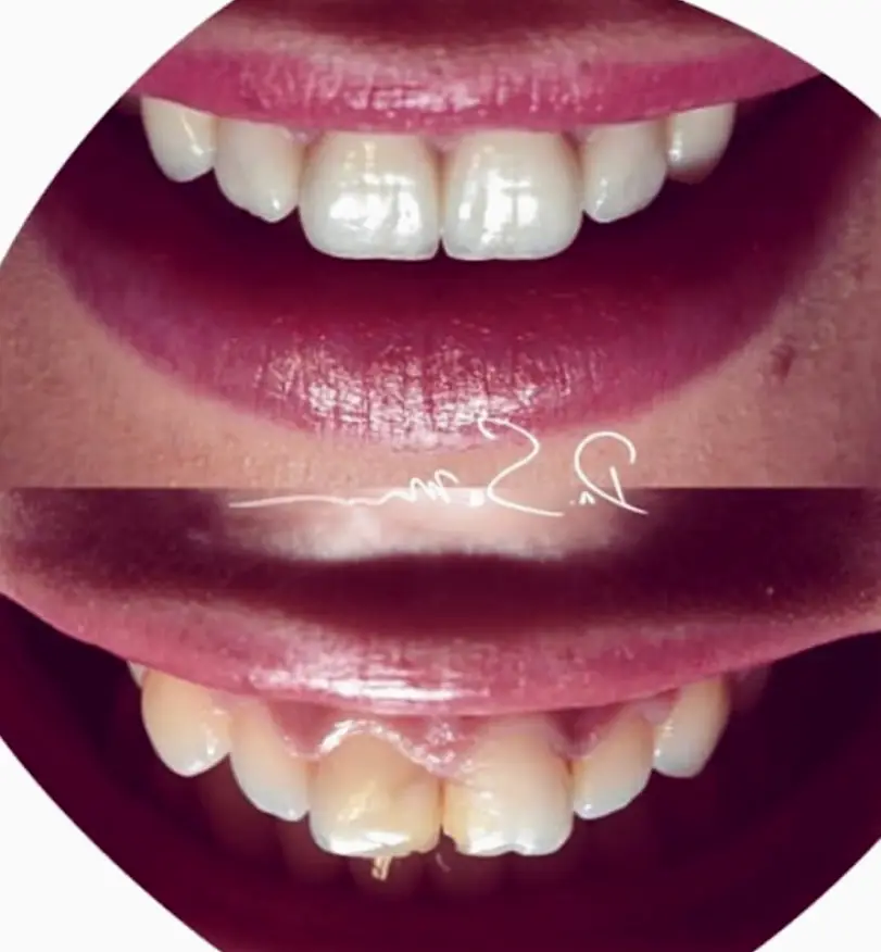  City Dental Centers Lake Forest, CA - Dentist in Lake Forest