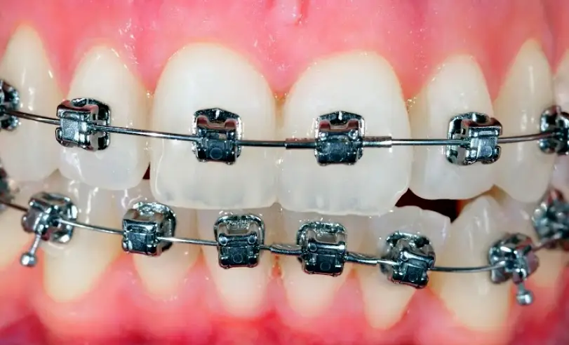 Temecula Choice Dental