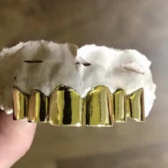 Baton Rouge First & Claiborne Gold Teeth