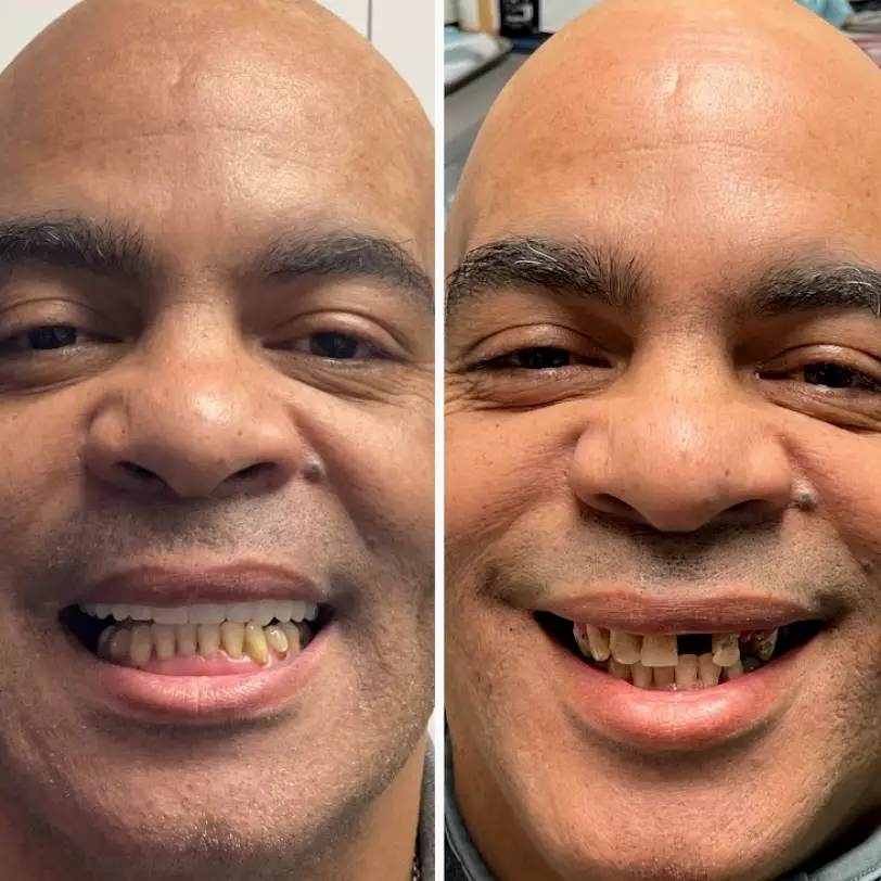 Glenside Signature Smile Dental Implant Center