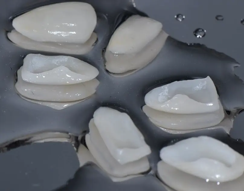 Katonah Northern Westchester Prosthodontics: Dr. Terry Y. Lin